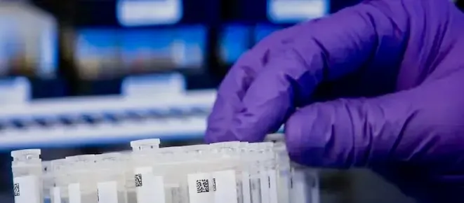 의료 분야에서 감열식 프린터가 도움이 될 수 있는 것